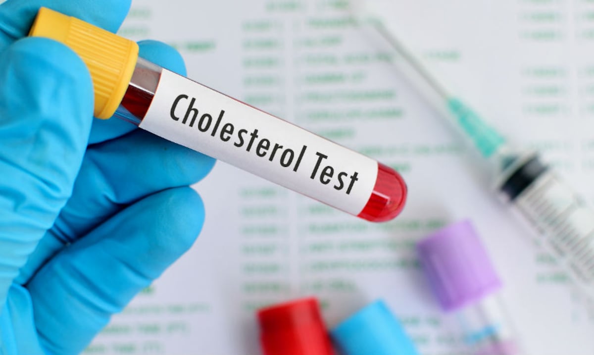 ¿Qué fruta ayuda a reducir el colesterol “malo”? Esta es la recomendación de un cardiólogo