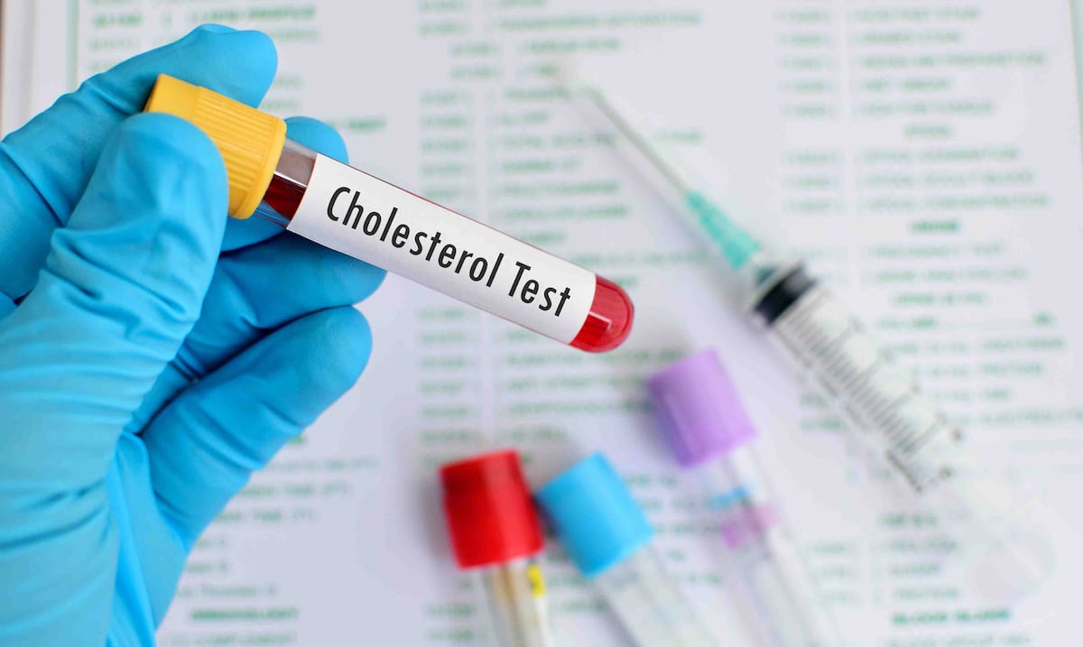 El fruto clave para reducir el colesterol malo en la sangre, según un cardiólogo de Nueva Jersey