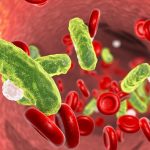 La sepsis: una complicación miedosa y altamente mortal