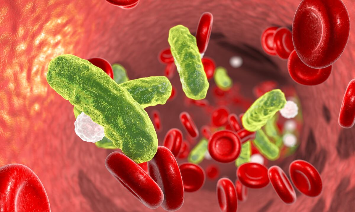 La sepsis: una complicación miedosa y altamente mortal
