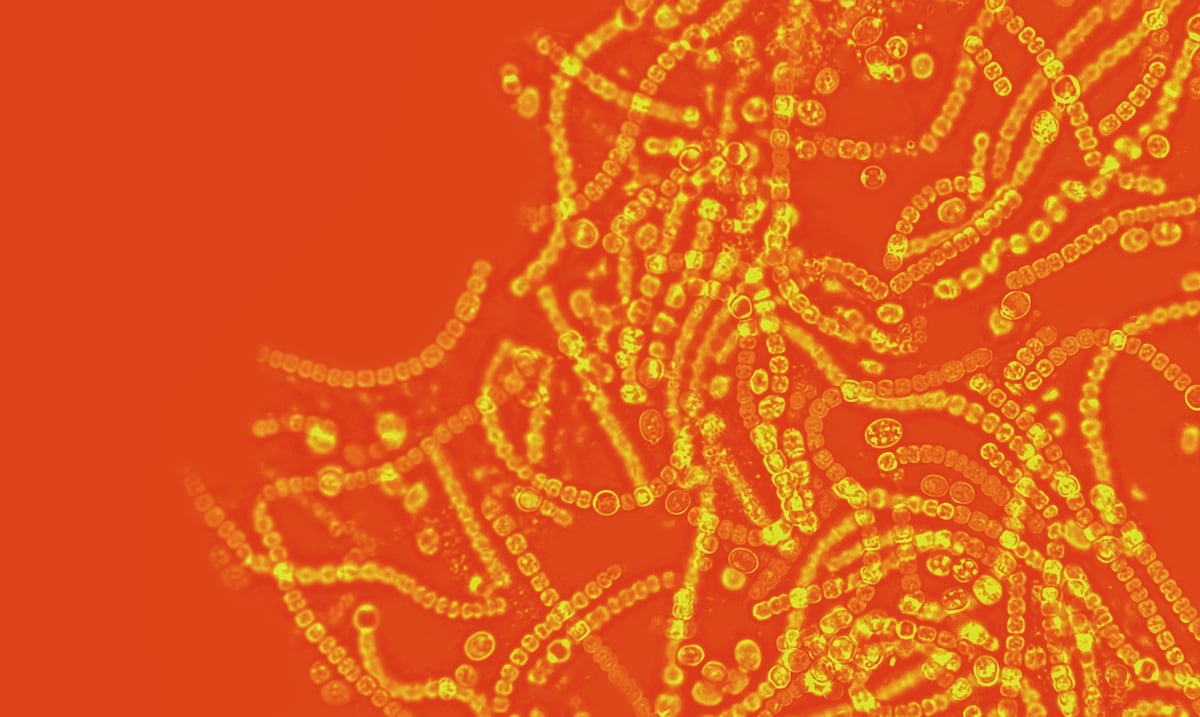 Opinión | Antibióticos y salud mental: una conexión inesperada