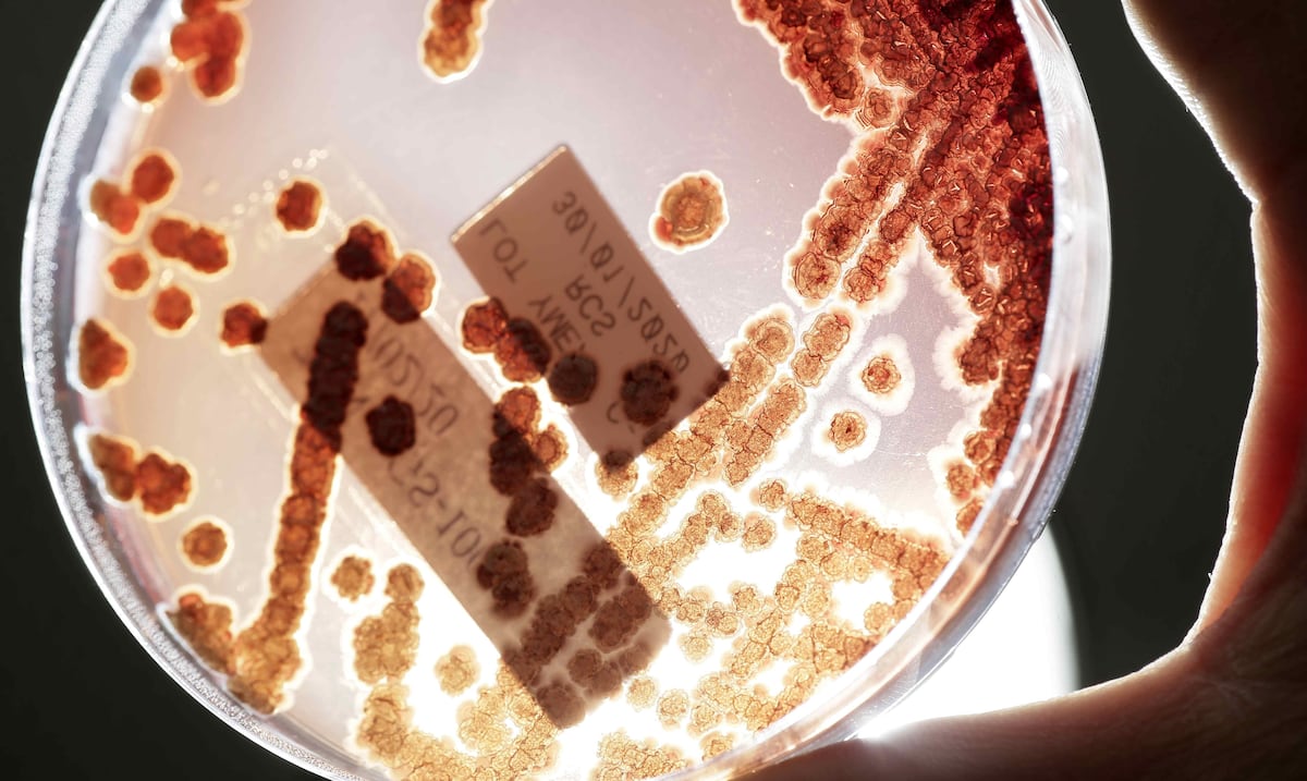 Hallan los responsables genéticos de la resistencia a los antibióticos en bacterias