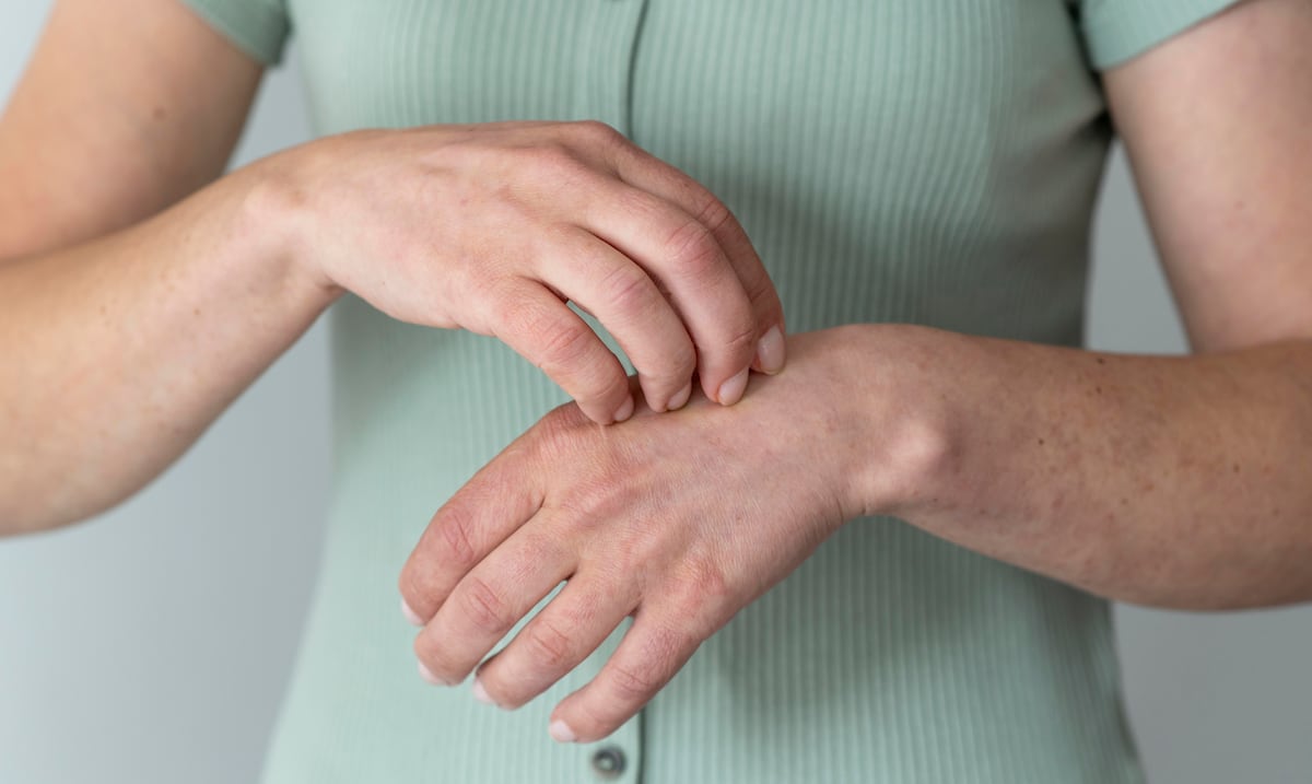 ¿Rascarse o no rascarse?: ¡esa es la cuestión!