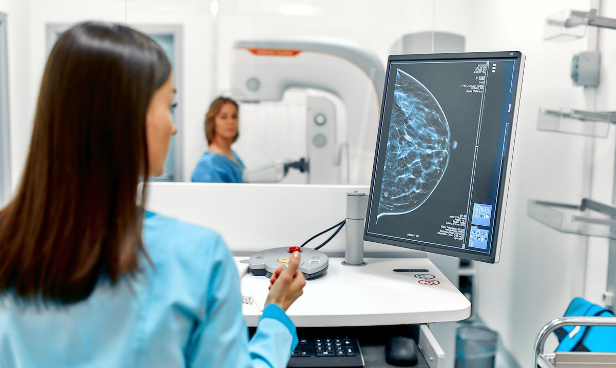Nuevos requisitos al momento de hacerte una mamografía