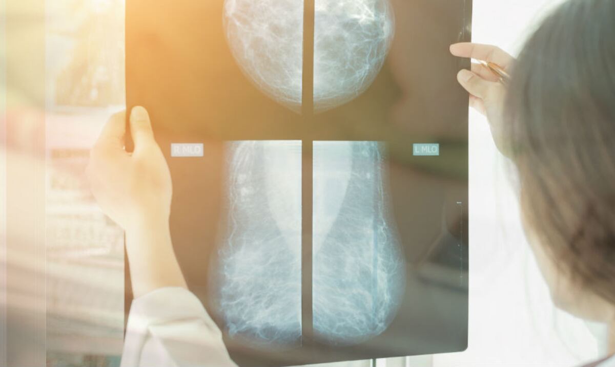 Misión: cambiar vidas, mamografía a mamografía