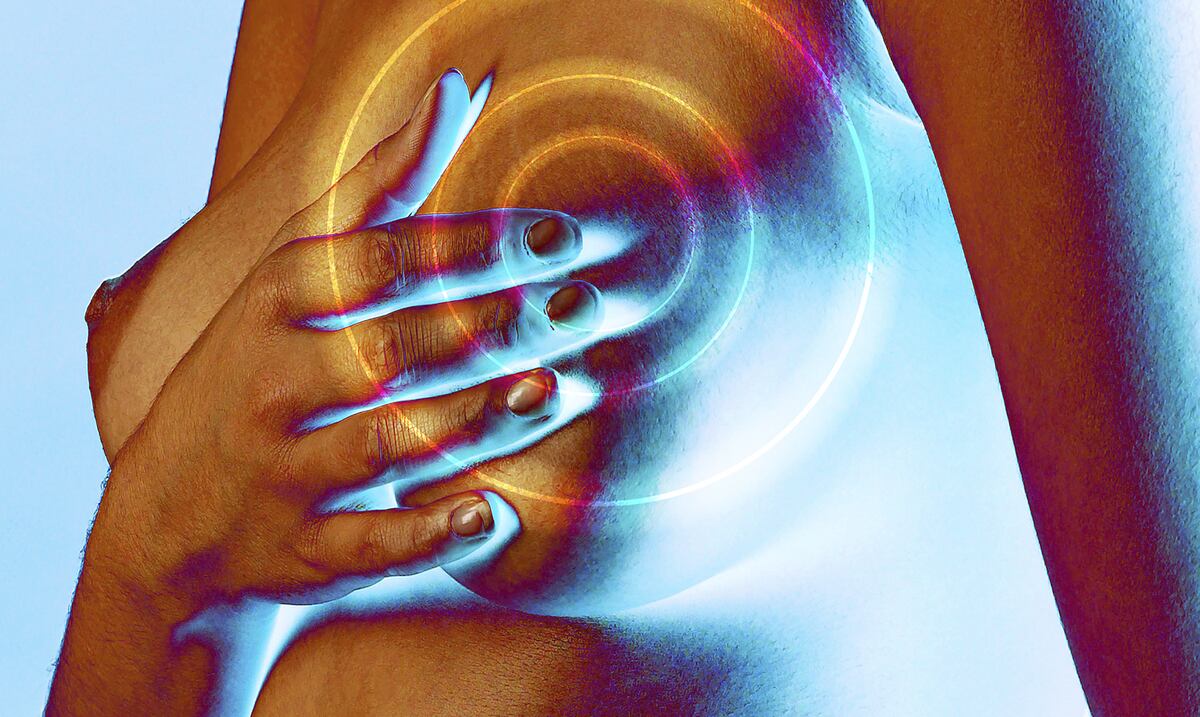 En el punto de mira de la inmunoterapia el cáncer de mama triple negativo