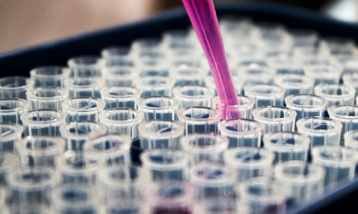 Estudian biomarcadores que ayuden a mejorar diagnóstico de la esclerosis