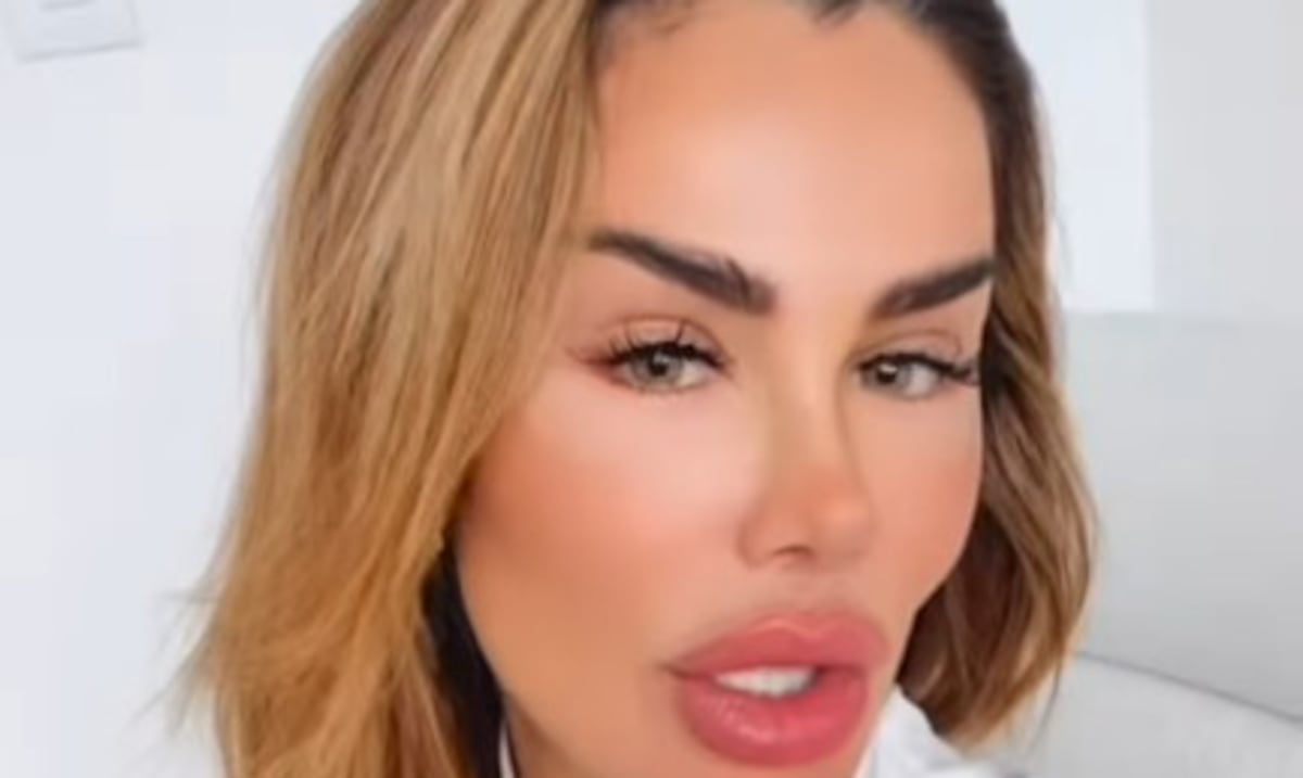 Lo que implica la queratopigmentación, proceso al que se sometió Ninel Conde para cambiar el color de sus ojos