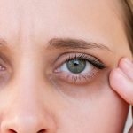 Dile adiós a las ojeras: remedios para dormir sin complicaciones