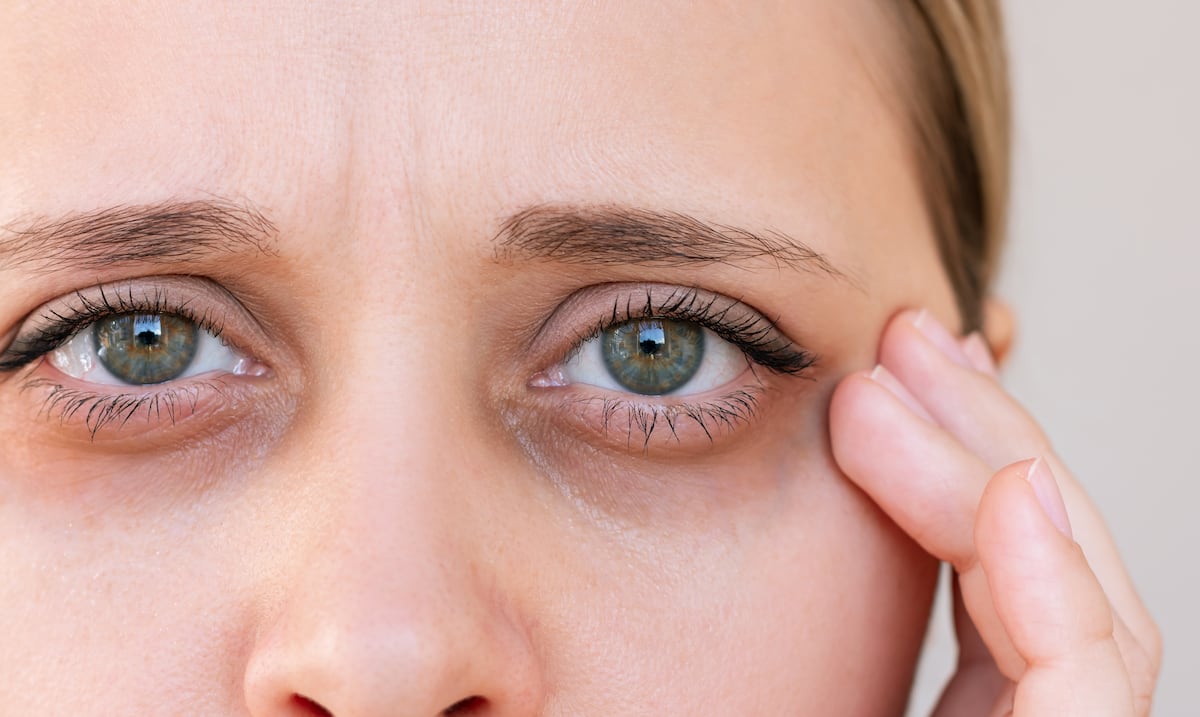 Dile adiós a las ojeras: remedios para dormir sin complicaciones