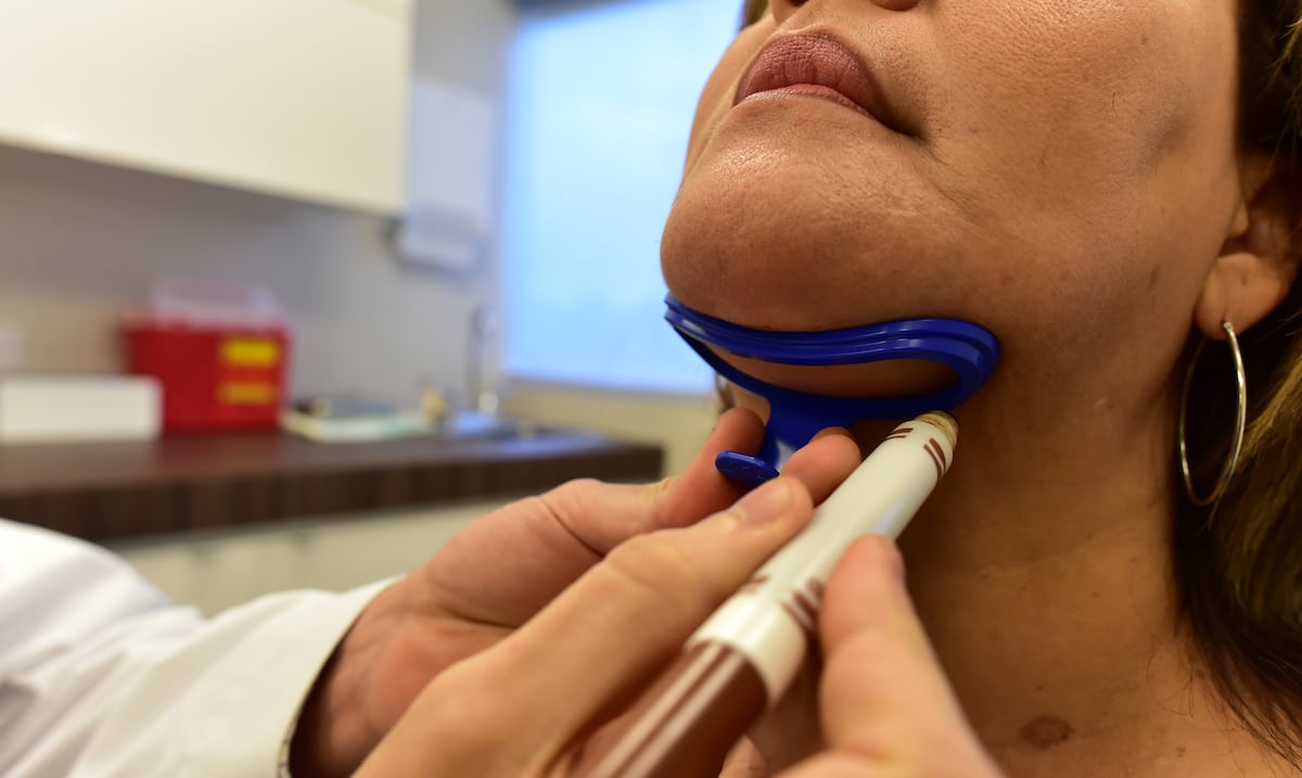 Cirugía estética en aumento: ¿por qué los hombres también se animan?