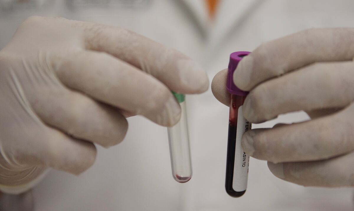 Los laboratorios se oponen a que las farmacias realicen pruebas de glucosa, COVID o colesterol a los clientes