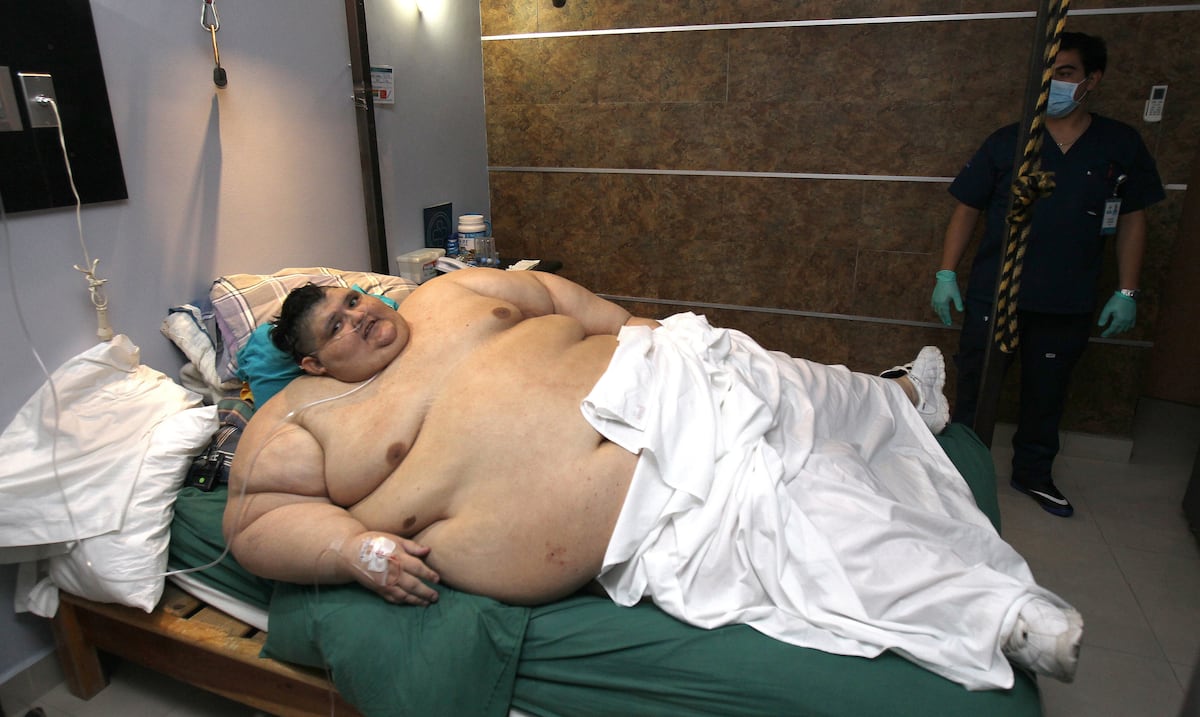 Muere el mexicano Juan Pedro Franco, conocido por haber sido el hombre más obeso del mundo