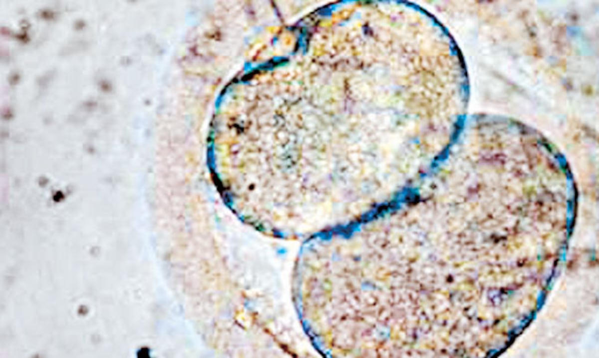 Opinión | Cuando la ley y la biología no coinciden