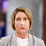 Hospital de Barcelona hace el primer trasplante de cara del mundo con donante de eutanasia