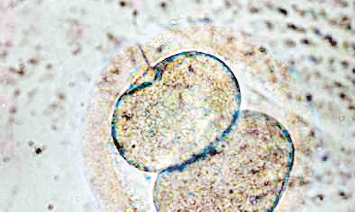 Opinión | More control and coercion over women’s bodies on the island