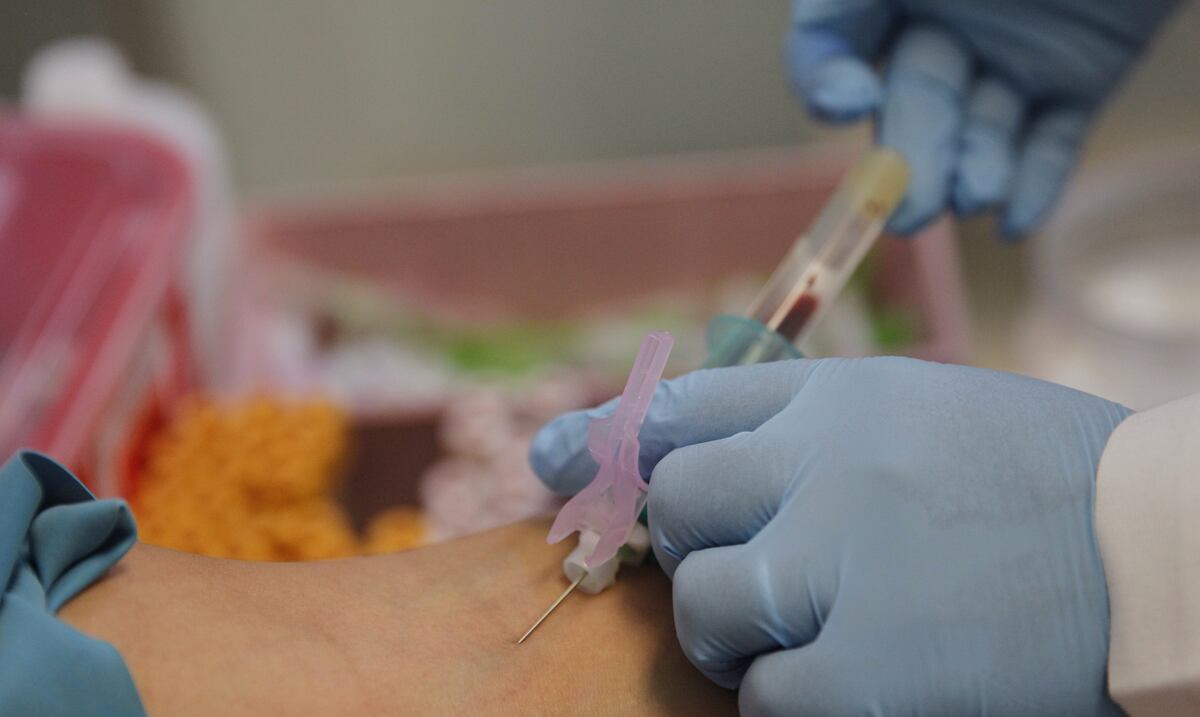 Un análisis de sangre permitiría diagnosticar el Alzheimer con una precisión del 95%