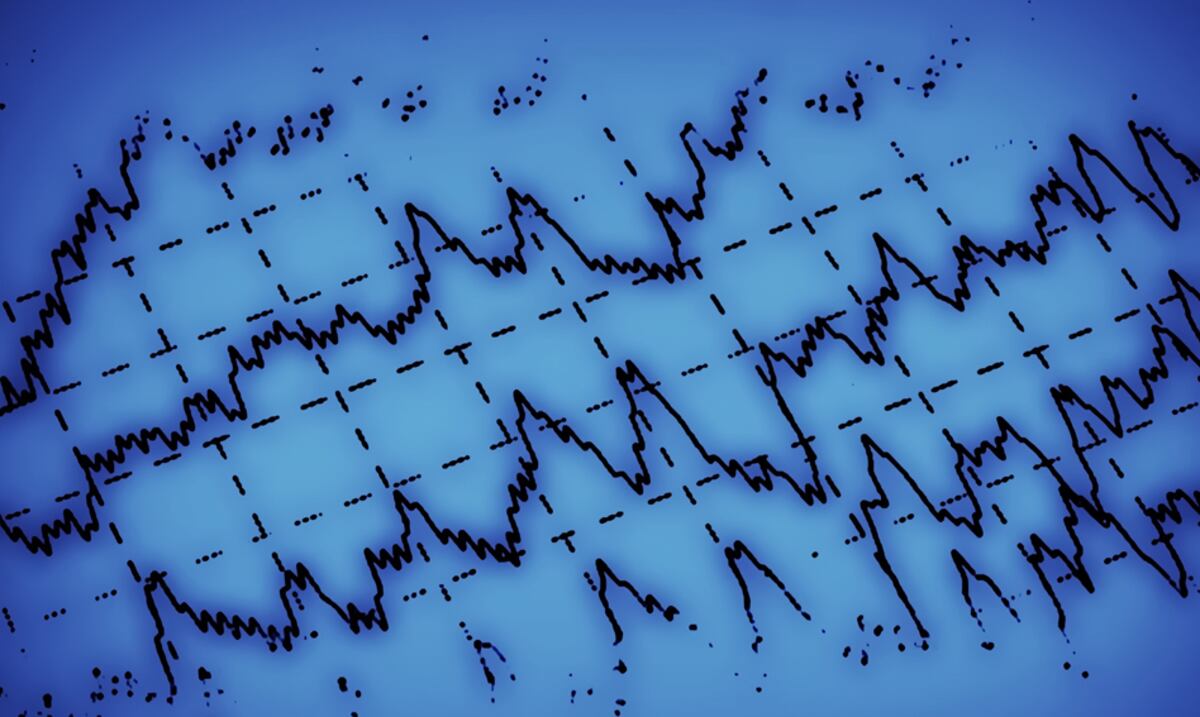 Conoce sobre la epilepsia: un trastorno cerebral que causa convulsiones