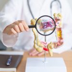 Cáncer colorrectal en aumento: conoce las señales de alerta