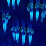 Identifican dos proteínas determinantes en el desarrollo del cáncer de piel