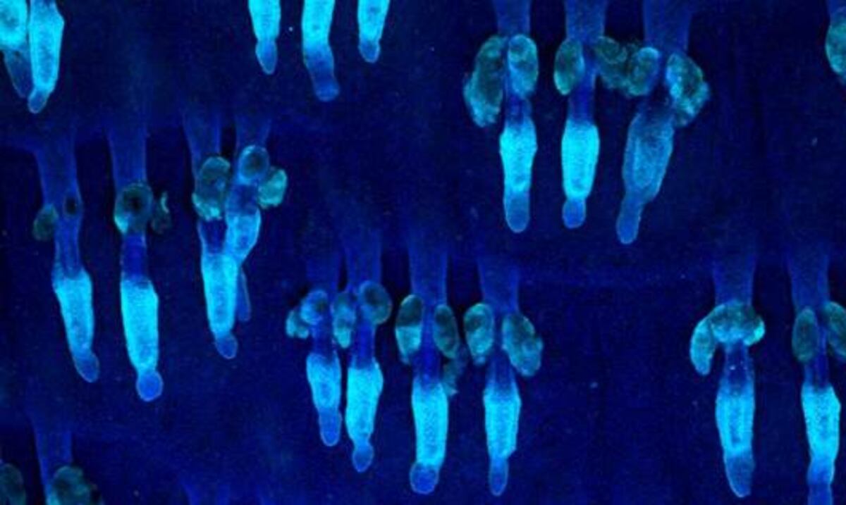 Identifican dos proteínas determinantes en el desarrollo del cáncer de piel