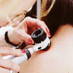 Prevención y detección temprana del melanoma