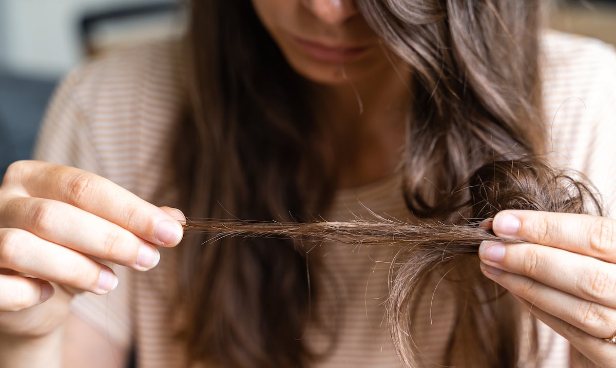 Calvicie femenina: causas y tratamientos de este “trastorno silencioso”