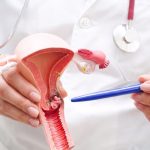 Importante llamado a mujeres de Puerto Rico a participar en estudio clínico para prevenir el cáncer cervical