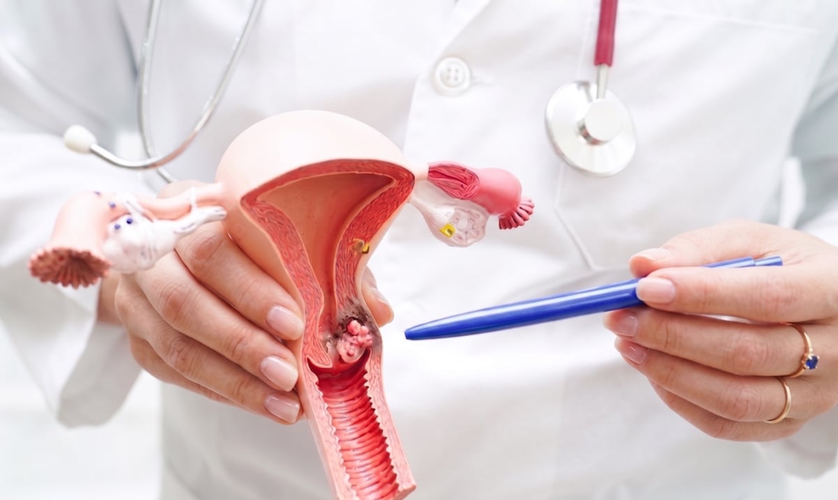 Importante llamado a mujeres de Puerto Rico a participar en estudio clínico para prevenir el cáncer cervical