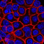 “Es un gran paso”: píldora experimental promete nueva esperanza contra el mortal cáncer de páncreas