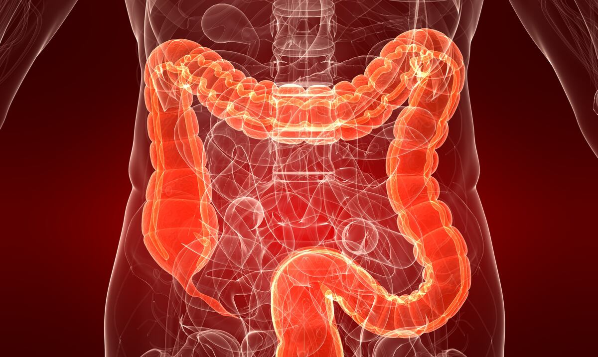 5 prácticas que ayudan a prevenir el cáncer colorrectal