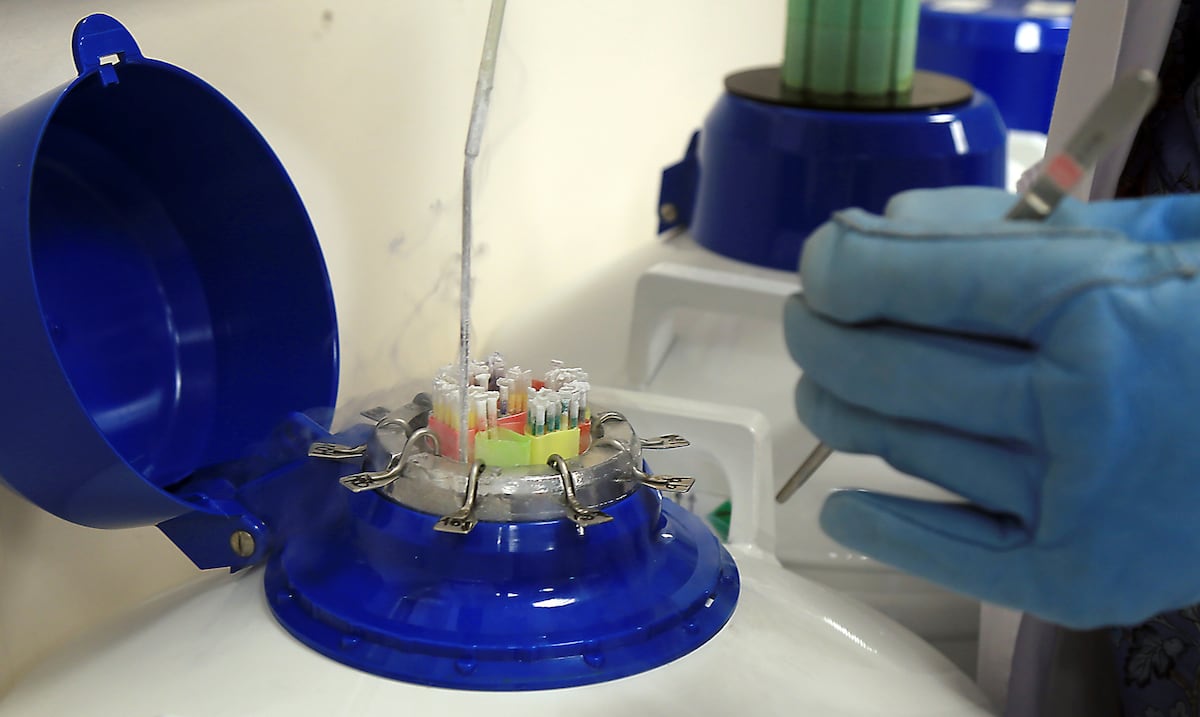 Estudio vincula la contaminación ambiental con una menor calidad del semen