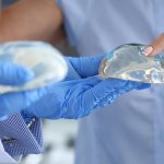 Implantes mamarios: ¿Silicona vs. salina? Conoce los mitos sobre su duración y cuándo realmente deben reemplazarse