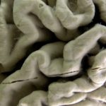 Un análisis de sangre puede ayudar a identificar a personas sanas con alto riesgo de padecer de Alzheimer