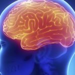Consejos para evitar un accidente cerebrovascular