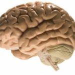Cómo prevenir o atender rápidamente un accidente cerebrovascular