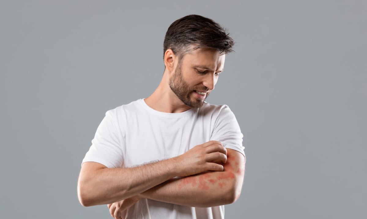 Jornada educativa y clínica dermatológica para celebrar el Día Mundial de la Psoriasis