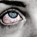 El ojo rojo: un problema muy común y de múltiples causas