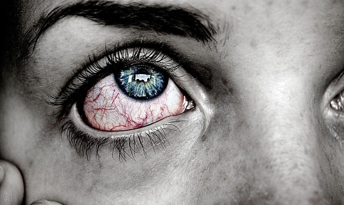 El ojo rojo: un problema muy común y de múltiples causas