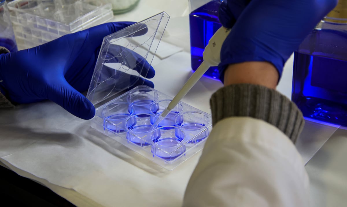 Opinión | Puerto Rico ante un nuevo avance contra el cáncer
