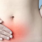 ¿Qué es la endometriosis?