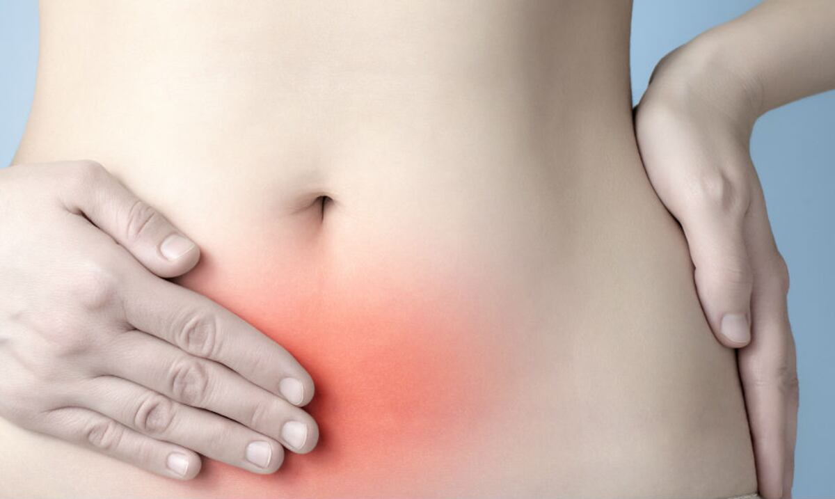 ¿Qué es la endometriosis?