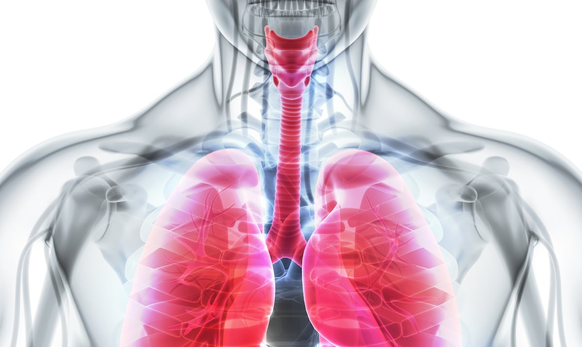 El mapa más amplio del cáncer de pulmón