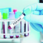 Nueva esperanza: 75% de pacientes con cáncer de próstata se curan con este tratamiento